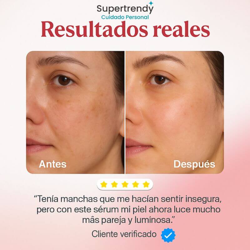 Anua Serum Coreano Despigmentante - Quita manchas y recupera la confianza en tu piel.