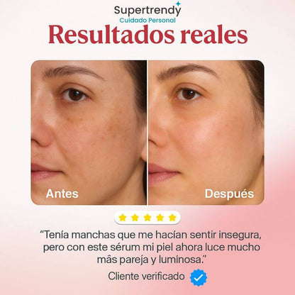 Anua Serum Coreano Despigmentante - Quita manchas y recupera la confianza en tu piel.
